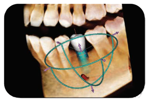 VATECH EZ 3d-i