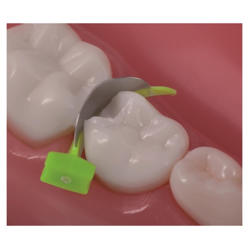 [64-806-98] FENDERMATE PRIME ASSORTIMENT 2X18 PCS     DIRECTA